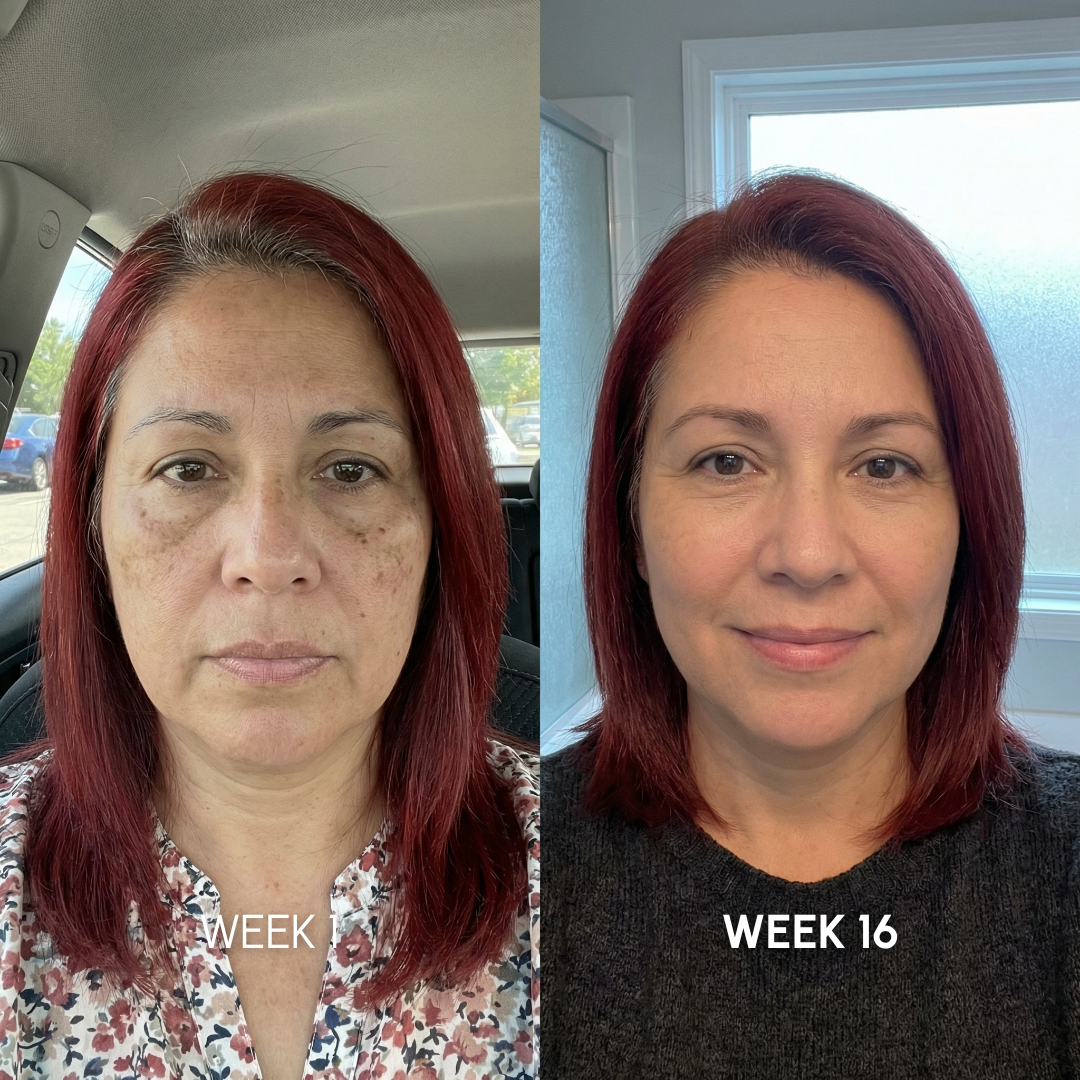 Noviqo™ – Collagen Renewal System