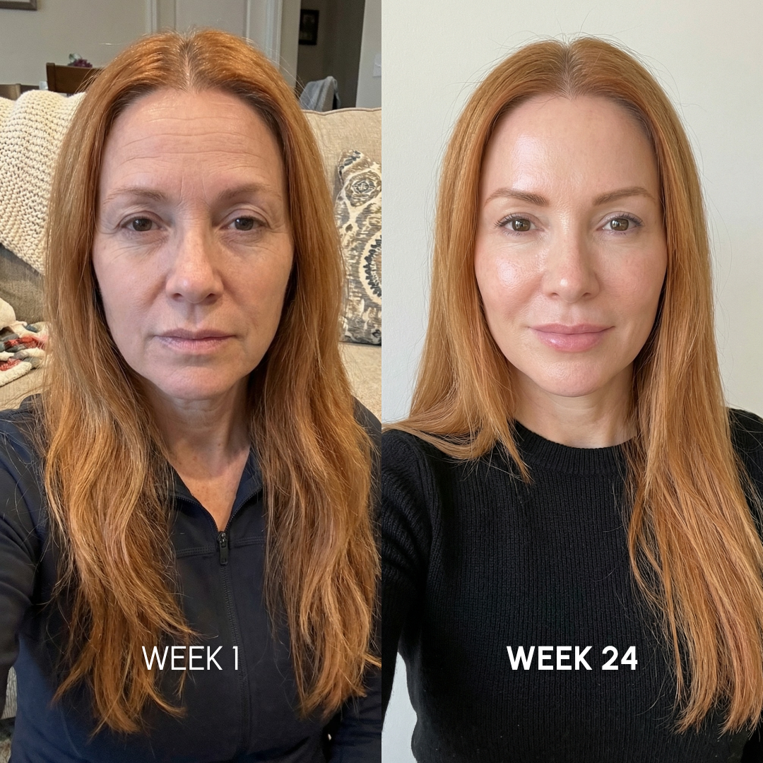 Noviqo™ – Collagen Renewal System